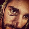 Seth_s_Bruise_WWE_Instagram.jpg